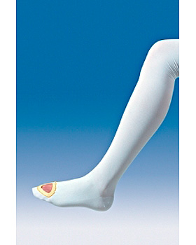 Cambren C Anti-Thrombose-Str�mpfe Gr. SM 2, mittel, schenkellang, 1 Paar