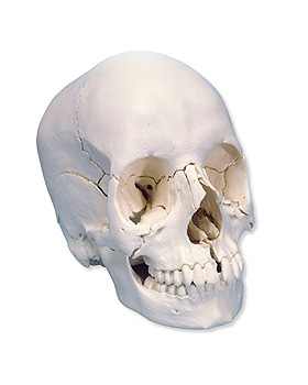 3B Scientific Steckschdel, Anatomische Version, 22-teilig, 3B Scientific, medishop.de