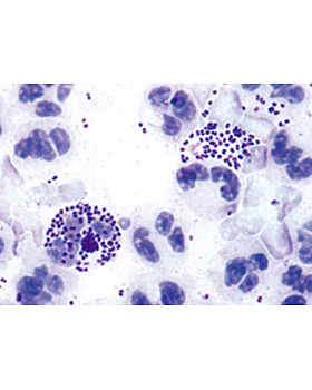 Bakterien als Krankheits- und Seuchenerreger, 25 Stck, 3B Scientific, medishop.de