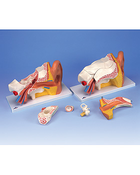 Riesen-Ohr - Erweiterte Version, 3-fache Gre, 6-teilig, 3B Scientific, medishop.de