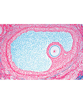 Fortpflanzungsorgane, 14 Stck, 3B Scientific, medishop.de