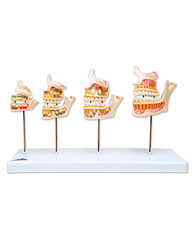 Gebißentwicklung, 3B Scientific, medishop.de