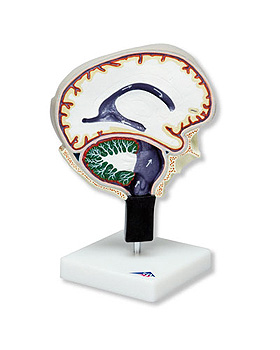 Hirnflssigkeitskreislauf, 3B Scientific, medishop.de
