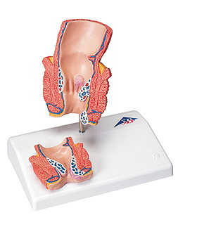 Hämorrhoidenmodell, 3B Scientific, medishop.de