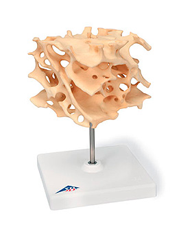 Knochenspongiosa (Schwammknochen) - 100-fach vergrößertes Replikat, 3B Scientific, medishop.de