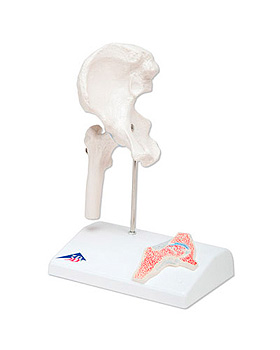 Mini-Hftgelenk mit Querschnitt, auf Sockel, 3B Scientific, medishop.de