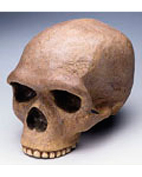 Anthropologischer Schdel - Steinheim, 3B Scientific, medishop.de
