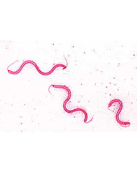 Bakterien, 25 Stck, 3B Scientific, medishop.de