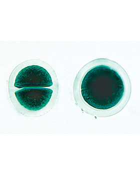 Algen (Algae), 30 Stck, 3B Scientific, medishop.de