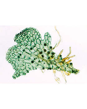 Farnpflanzen (Pteridophyta), 15 Stck, 3B Scientific, medishop.de