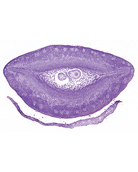 Bltenpflanzen VII. Frucht und Samen, 15 Stck, 3B Scientific, medishop.de