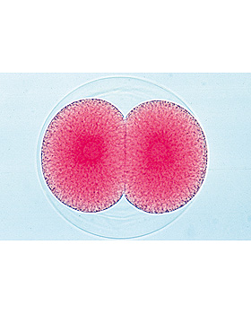 Entwicklung des Seeigels (Psammechinus miliaris), 12 Stck, 3B Scientific, medishop.de