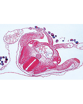 Entwicklung des Huhnembryos (Gallus), 10 Stck, 3B Scientific, medishop.de