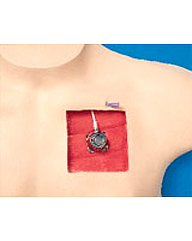 Zentralvenenkatheter-Simulator mit implantiertem Port, 3B Scientific, medishop.de