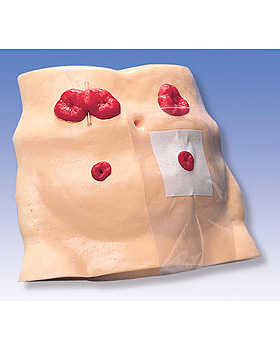 Stomapflege-Simulator W43027, 3B Scientific, medishop.de