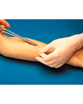 Nahtbungsarm, 3B Scientific, medishop.de