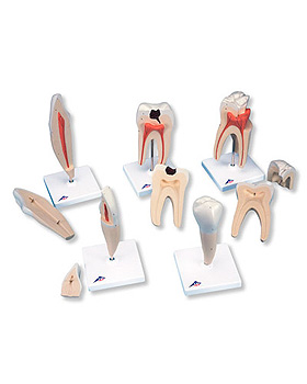 Zahnmodellserie, 5 Modelle, 3B Scientific, medishop.de