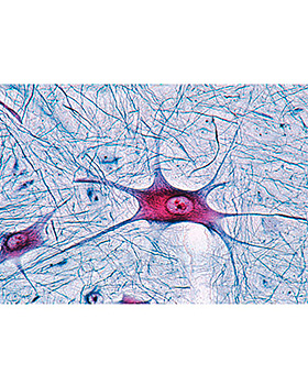 Zentralnervensystem, 11 Stck, 3B Scientific, medishop.de