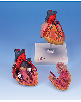 Klassik-Herz mit Bypass, 2-teilig, 3B Scientific, medishop.de