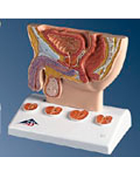 Prostata-Modell, 3B Scientific, medishop.de