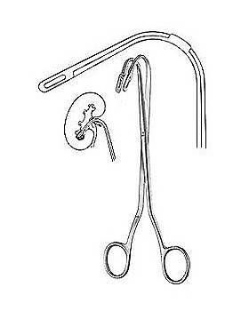 RANDALL, Nierensteinzange, 19cm, Figur 5, Allgaier Instrumente, medishop.de