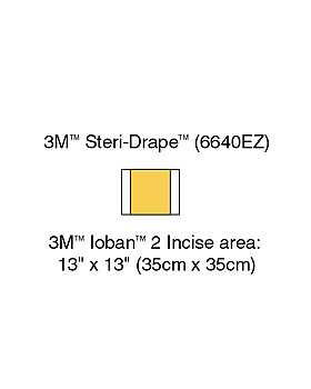 3M Ioban 2 Inzisionsfolien 35 x 45 cm Inzisionsfeld 35 x 35 cm (10 Stck.), 4 Packungen, 3M Medica, medishop.de