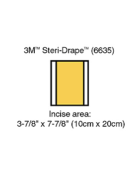 3M Ioban 2 Inzisionsfolien 10 x 20 cm Inzisionsfeld 10 x 20 cm (10 Stck.), 3M Medica, medishop.de