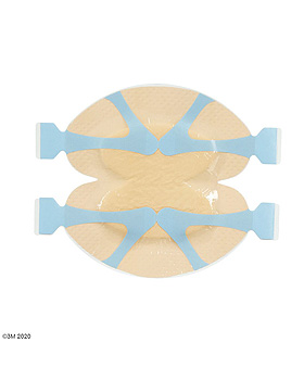 3M Tegaderm Silicone Foam Border Schaumverband 16,5 x 16,5 cm (5 Stck.), 3M Medica, medishop.de