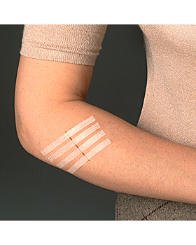 3M Steri-Strip Wundverschlussstreifen 3 x 75 mm (12 x 5 Str.), 3M Medica, medishop.de