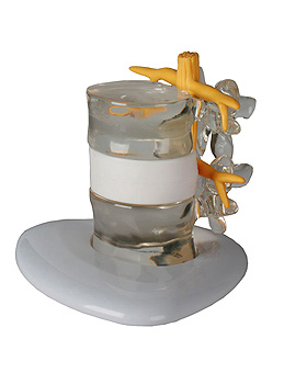 Bandscheibenvorfall-Simulator, Erler-Zimmer, medishop.de