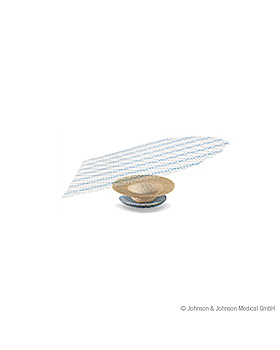 ULTRAPRO Plug mittel MONOCRYL-PROLENE-Composite, Ethicon, medishop.de