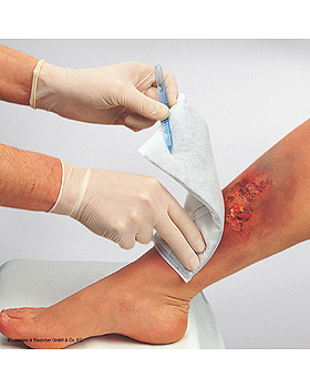 Vliwaktiv Aktivkohleverband, steril, 10 x 20 cm (20 Stck.), Lohmann und Rauscher, medishop.de