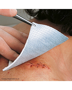 Metalline Kompressen steril, 10 x 12 cm (10 Stck.), Lohmann und Rauscher, medishop.de