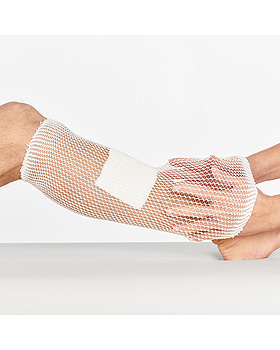 miro-fix S Netzschlauchverband Gr. B, 25 m, Miro, medishop.de