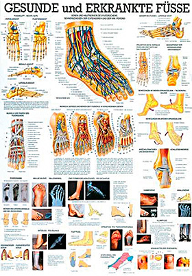 anat. Lehrtafel: Gesunde und erkrankte Fe 70 x 100 cm, laminiert, Rdiger Anatomie, medishop.de