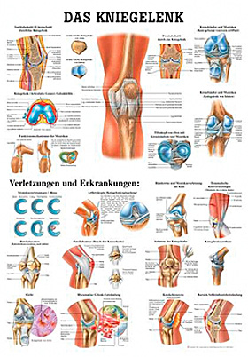anat. Lehrtafel: Das Kniegelenk 70 x 100 cm, Papier, Rdiger Anatomie, medishop.de