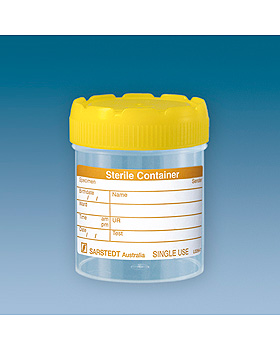 Mehrzweck-Becher 70 ml mit montiertem Schraubverschluss gelb (200 Stck.), Sarstedt, medishop.de