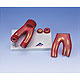 Arteriosklerose Modell, mit Querschnitt der Arterie (2-teilig), 1 Stück